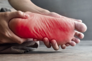 Facts About Diabetic Neuropathy in the Feet